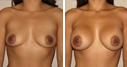 Before & After Photos
